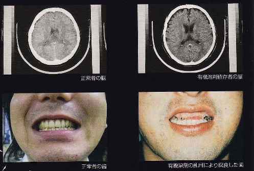 有機溶剤乱用結果